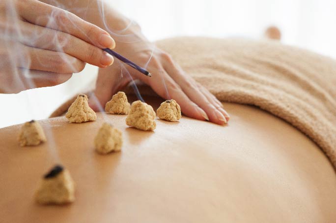 灸イメージ写真